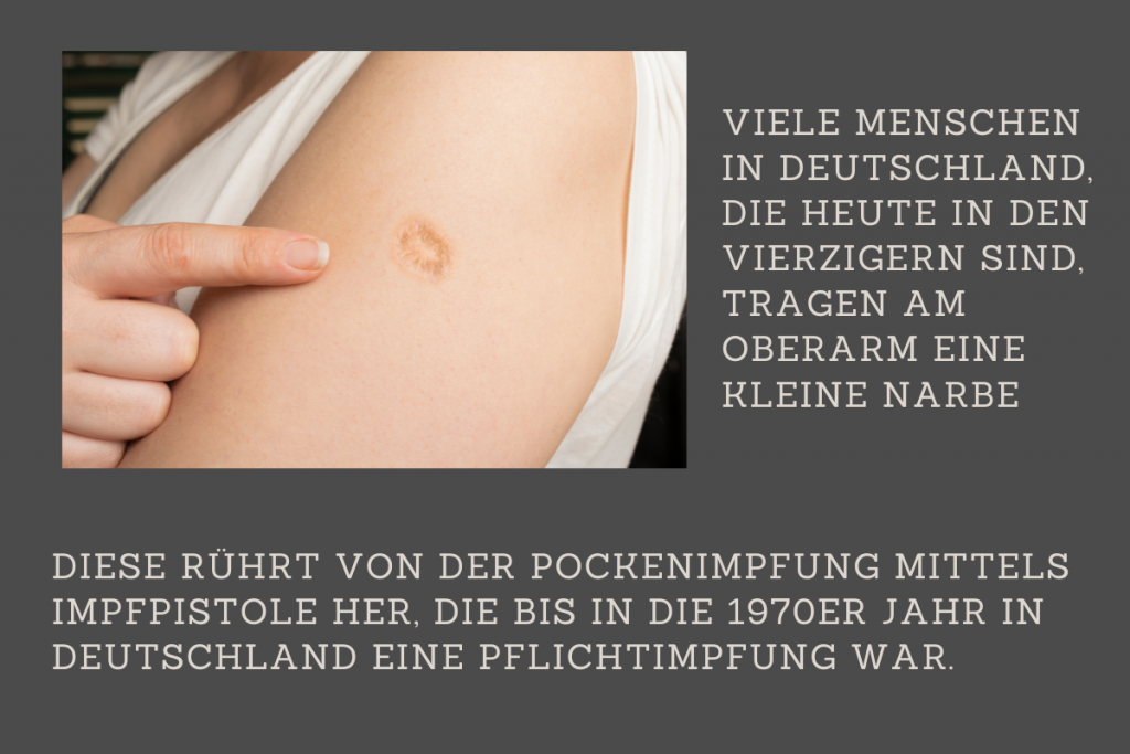 Die Narben der Pockenimpfung